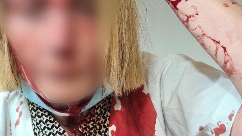 בשל אלימות קשה במרפאה בבאר יעקב: הרופאים הכריזו על שביתה בת יומיים